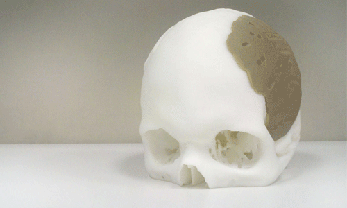 3D-Printed-Skull-3D Printing Ideas